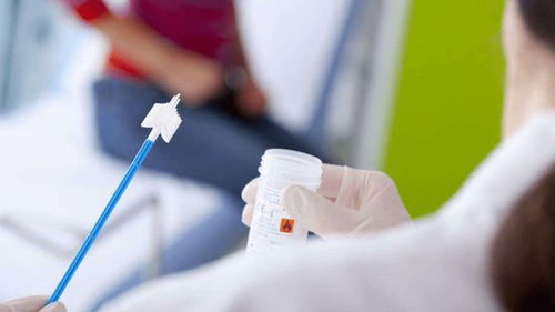 肛门周围长了小肉芽是怎么回事 北京和平中西医结合医院医生详解